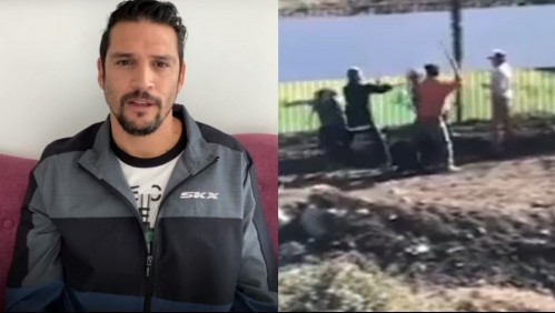 Mark González tras sufrir agresión: 'El apoyo de la gente ha sido súper emocionante'
