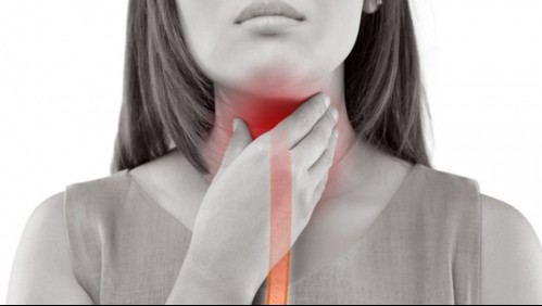 ¿Sufres de reflujo? Estos son los 6 tipos de alimentos que tienes que evitar