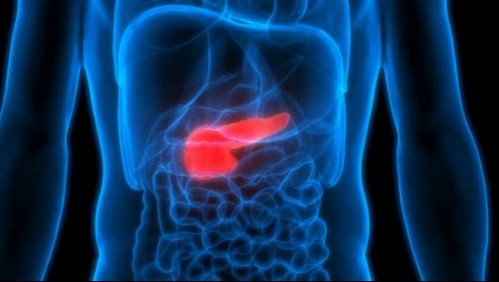 Cáncer de Páncreas: Los síntomas que te ayudarán a detectar la enfermedad