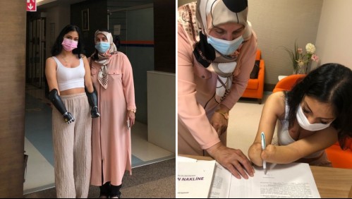 Joven sufre amputaciones pero se salva de morir gracias a riñón donado por su mamá