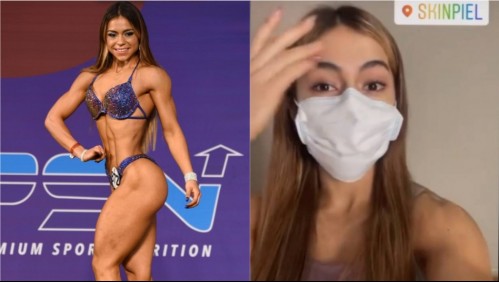 Influencer muere tras tratamiento contra la sudoración: Le inyectaron anestesia en las axilas