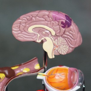 Estudio indica que Covid-19 podría acelerar los síntomas del alzheimer Estudio indica que Covid-19 podría acelerar los síntomas del alzheimer