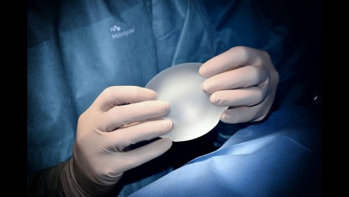 'Narcoestética': Traficantes pagan cirugías a mujeres a cambio de favores sexuales