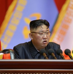 La misteriosa marca verde en la cabeza de Kim Jong-Un en su reciente aparición pública La misteriosa marca verde en la cabeza de Kim Jong-Un en su reciente aparición pública