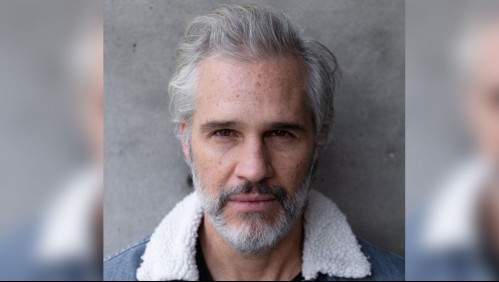 ¿Cómo una trombosis termina en amputación? El caso del actor que perdió una pierna