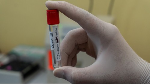 Solo con saliva y en una hora: Inventan dispositivo que detecta Covid-19 con eficacia de un PCR