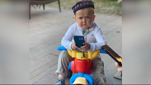 Acondroplasia: La extraña enfermedad que padece el 'niño' ruso que revolucionó las redes sociales