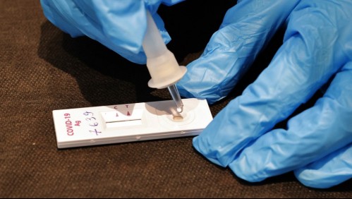 Variante Gamma: Cuáles son los síntomas de la mutación con más casos en Chile