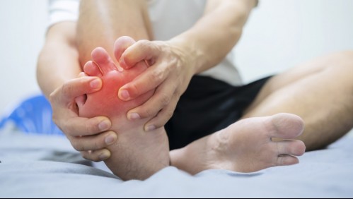 Genera dolores en articulaciones: Estos son los síntomas de la gota