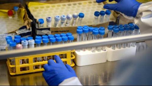 Revisa la cantidad de casos activos de coronavirus por región y las comunas de la RM más afectadas