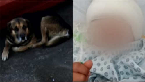 Niño de 4 años debió ser operado tras brutal ataque de perro callejero en Renca: 'Ha sido terrible'