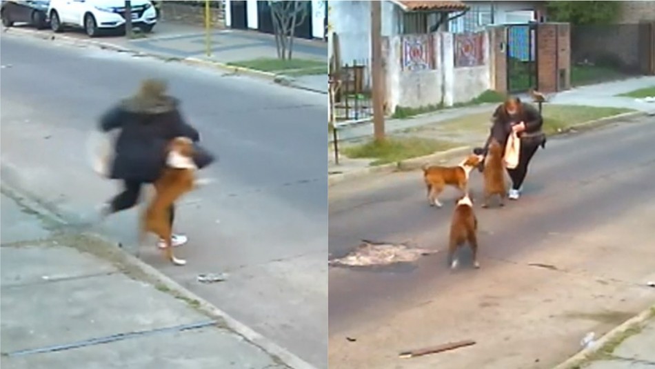 mujer-fue-atacada-por-un-grupo-de-perros-en-argentina Mujer agredida brutalmente por perros quedó con ataques de pánico y está