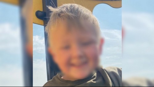 Niño de 4 años sufre graves quemaduras mientras se bañaba: el jabón le explotó en la cara