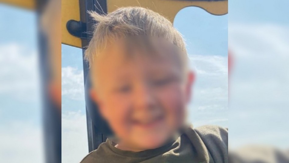 nino-de-4-anos-sufre-graves-quemaduras-en-su-cara-y-su-cuerpo-en-inglaterra Niño de 4 años sufre graves quemaduras mientras se bañaba: el jabón le explotó en la cara