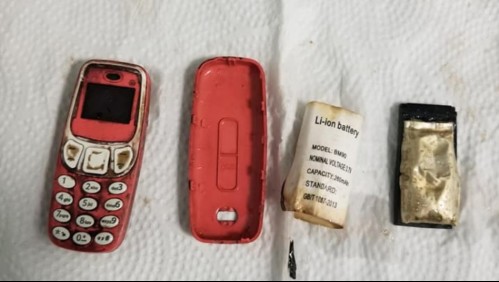 Hombre se tragó un celular y debieron operarlo de urgencia