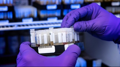 Estudio indica que personas que contrajeron Covid-19 y se vacunaron tendrían 'inmunidad súper humana'