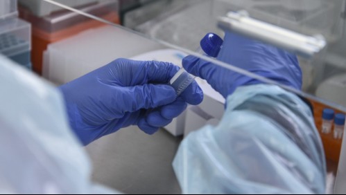 Presunto paciente con lepra en Temuco se encuentra 'hospitalizado y control médico' a la espera de resultado de biopsia