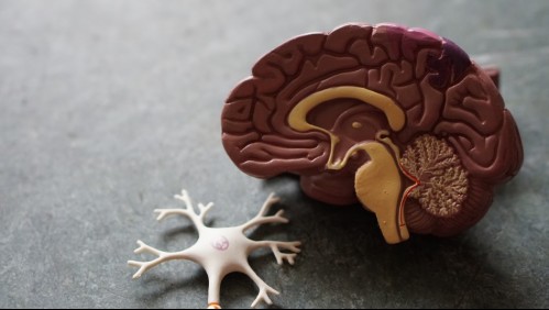 Mal de Alzheimer: Conoce las primeras señales con las que se manifiesta la enfermedad