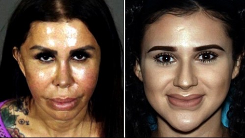 Madre e hija fingen ser doctoras y ahora son acusadas de asesinar a una mujer tras cirugía estética ilegal