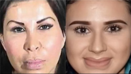 Madre e hija son acusadas de realizar cirugía estética ilegal: Paciente de 26 años murió a raíz del procedimiento