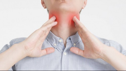 ¿Dolor de garganta y fiebre?: Conoce los síntomas de los ganglios linfáticos inflamados
