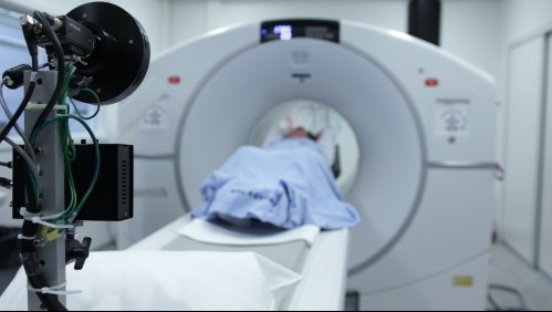 Enfermedades al cerebro: ¿Cuáles son los principales síntomas?