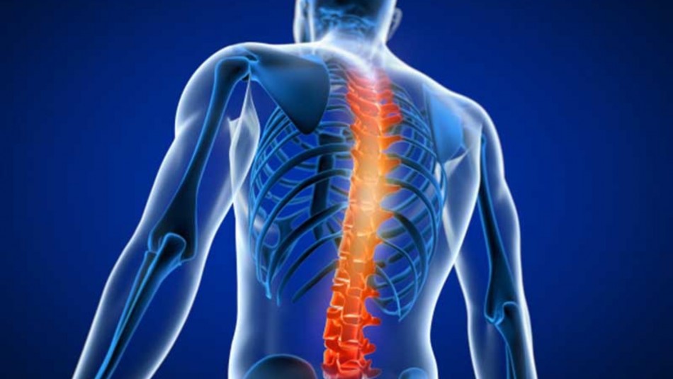 Cáncer de columna: Conoce cómo reconocer los tumores que afectan a dicha zona Cáncer de columna: Conoce cómo reconocer los tumores que afectan a dicha zona