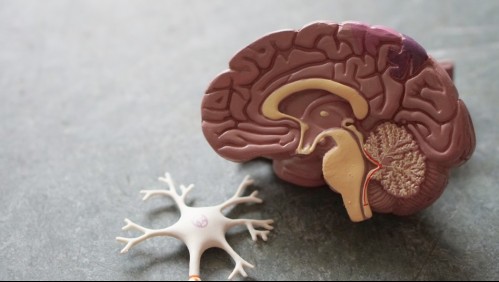 Nuevo estudio podría haber encontrado las causas tras el alzhéimer