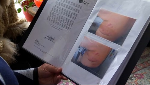 'Nos sentimos vulneradas': Mujeres que sufren cáncer de mama aseguran no ser escuchadas al decidir sobre su cuerpo