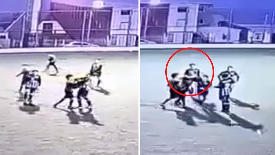 Le rompen la mandíbula a un jugador en un partido de fútbol y ahora no puede hablar Le rompen la mandíbula a un jugador en un partido de fútbol y ahora no puede hablar