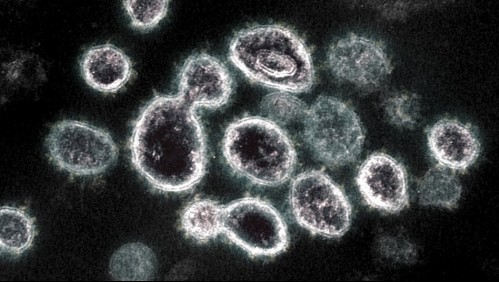 Alza de casos de coronavirus en Chile: Estas son las razones