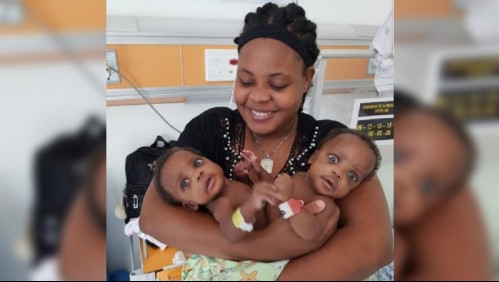 'Tengo la esperanza de que se van a separar': Padres de siamesas están optimistas por operación a sus hijas