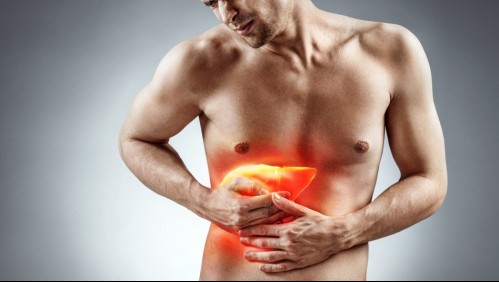 Cirrosis hepática: Estos son los síntomas y las causas de la peligrosa enfermedad