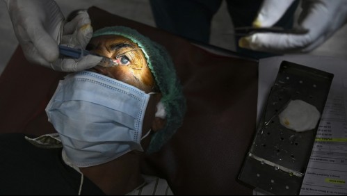Millones de indios recuperan la vista por cirugía inspirada en la comida rápida