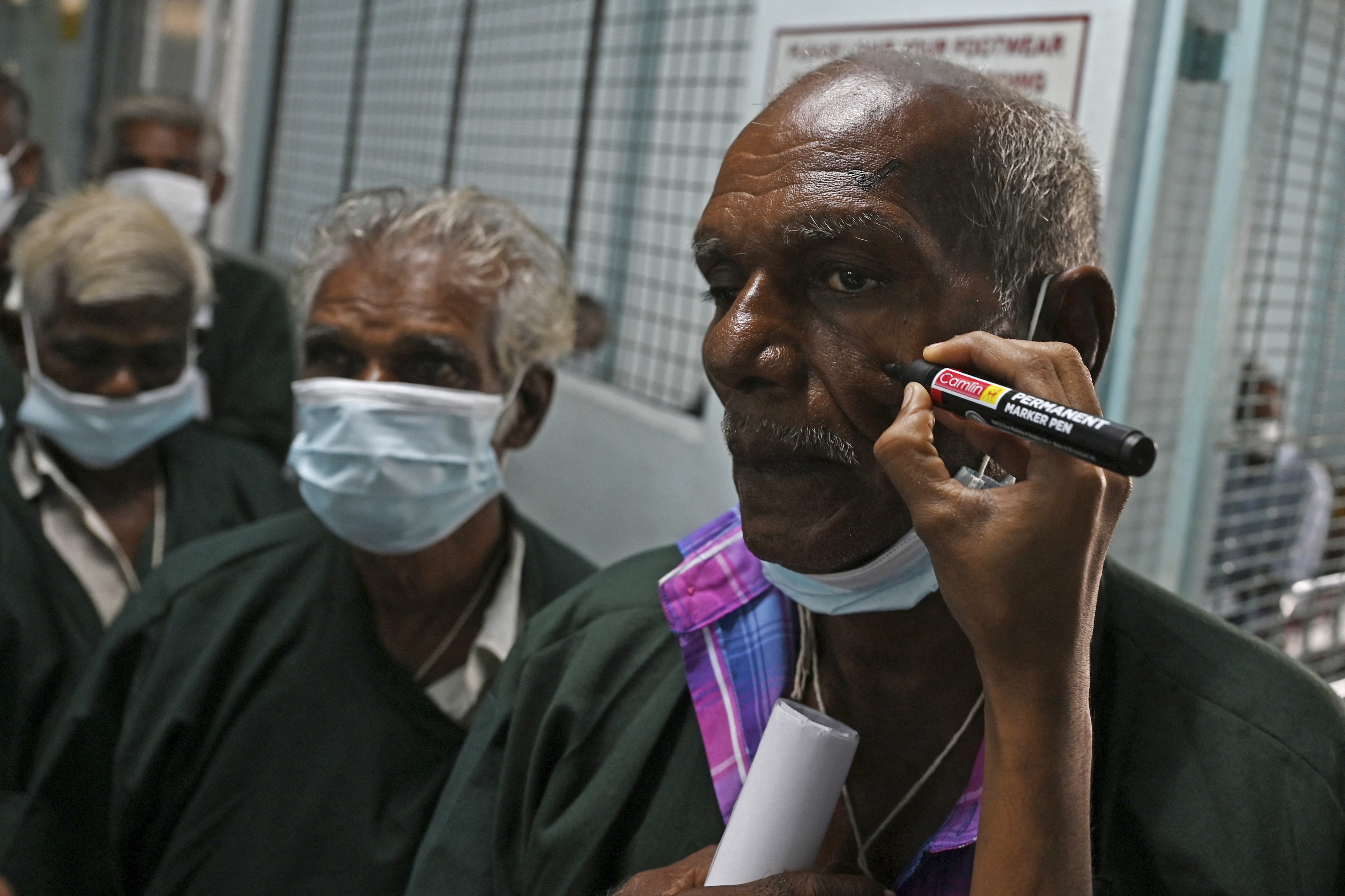 Personal médico marcando el ojo que se debe operar en cada paciente