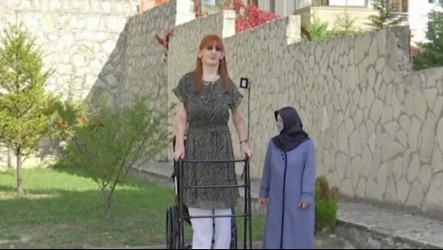La historia de la mujer más alta del mundo: su estatura se debe a que padece del extraño síndrome de Weaver