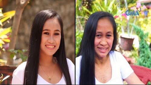 Tiene 16 pero parece de 50: Joven padece enfermedad incurable que le produce envejecimiento