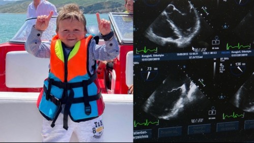 Acondroplasia: La extraña condición que padece Hasbulla Magomedov, el 'niño' ruso que revolucionó las redes sociales