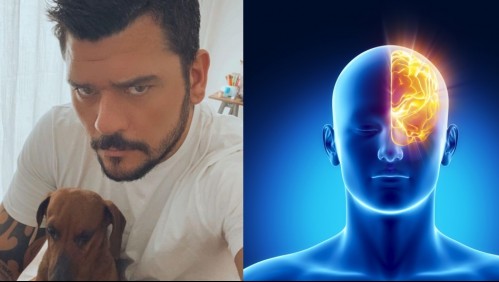 Cefalea en racimos: La condición que afecta al marido de Karen Bejarano