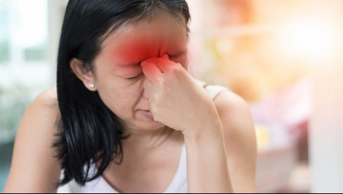 Sinusitis: Estos son los síntomas que te ayudarán a identificar si padeces de la infección