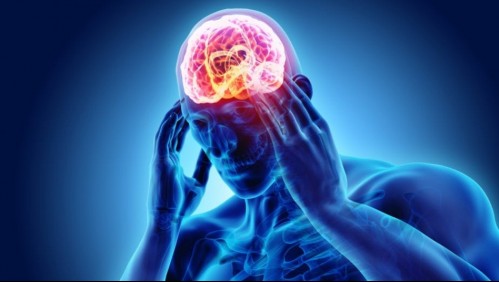 Cuídate: Estos son los síntomas que alertan problemas en el cerebro