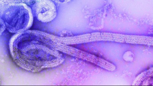 Virus de Marburgo: Aclaran que no es una nueva enfermedad pero sí es altamente mortal