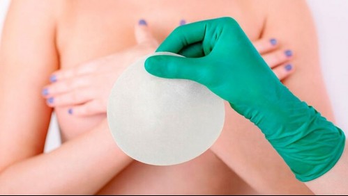 Alertan sobre el uso de los implantes mamarios y exigen reforzar requisitos de seguridad a cirujanos