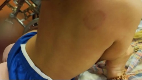 Detienen a mujer por agredir a mordiscos a su hijo de dos años: Fue denunciada por la abuela del menor