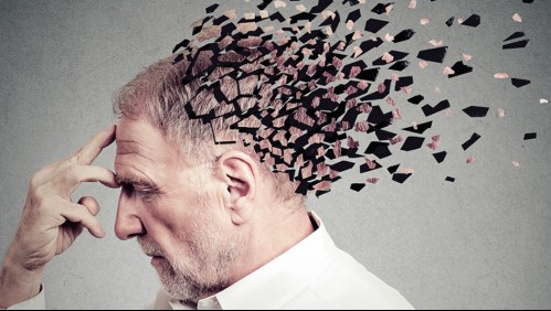 Estos son los primeros síntomas de la demencia a los que debes estar atento