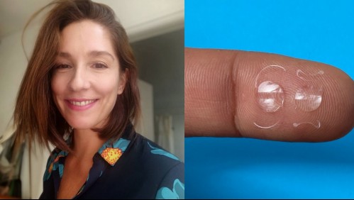 Estos son los lentes intraoculares que se colocó Mariana Loyola para mejorar su visión