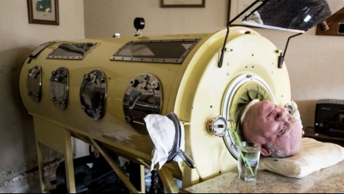 Hombre que contrajo polio hace 70 años vive atrapado en un pulmón de acero para sobrevivir: 'Nunca me rendí'