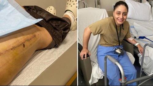 Casi pierde la pierna tras una sesión de spinning por una rara condición: 'Mis rodillas simplemente cedieron y me caí'