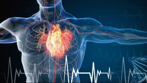 Infarto femenino: Estos son los síntomas de los ataques cardiacos en mujeres