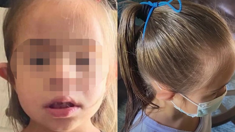 Polémica por profesora que amarró una mascarilla en la cabeza de una niña con Síndrome de Down para que no se la quitara
